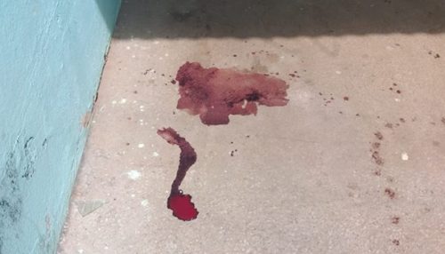 Mulher é esfaqueada pelo companheiro em Iacri