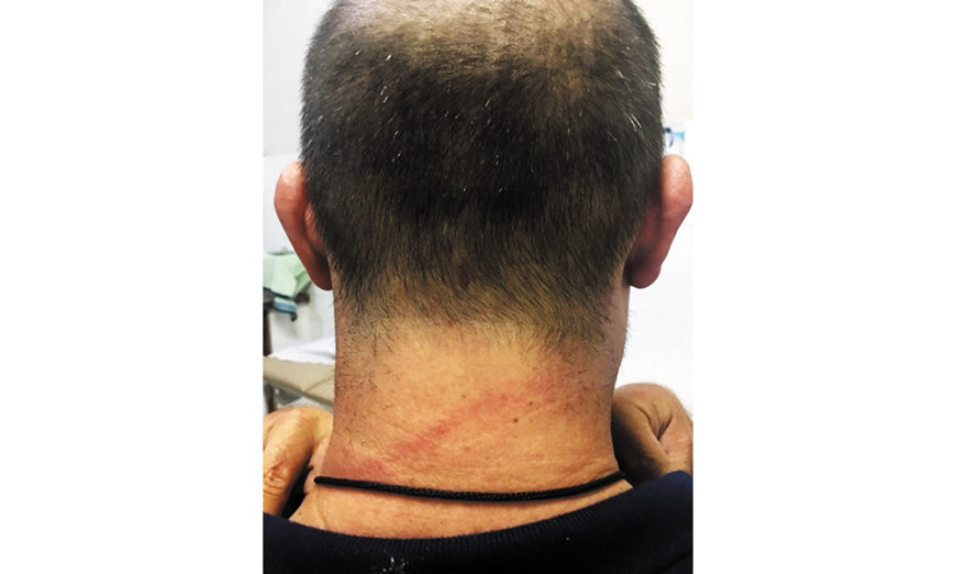 Presos agridem agente penitenciário em presídio de Pacaembu