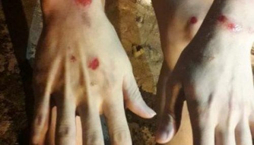 Jovem é agredido em Tupã e alega homofobia