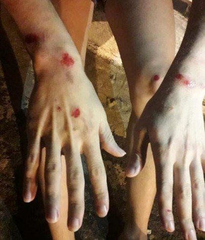 Jovem é agredido em Tupã e alega homofobia