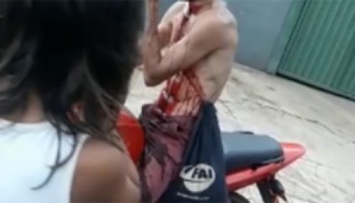 Motociclista ferido por linha cortante em Panorama passa por cirurgia e segue internado na UTI em Dracena