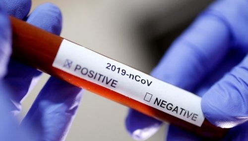 Irapuru tem três casos positivos de Covid-19