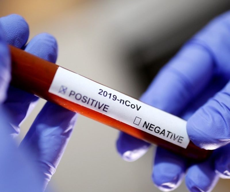 Irapuru tem três casos positivos de Covid-19