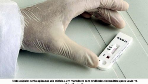 Saúde de Adamantina adquire 1000 testes rápidos para Covid-19