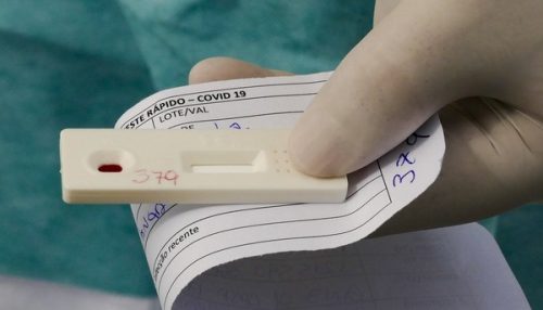 Secretaria de Saúde de Adamantina adquire mil testes rápidos para COVID-19