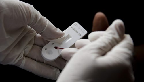 Testagem gratuita de Covid-19 é oferecida na Rodovia Raposo Tavares em Presidente Prudente