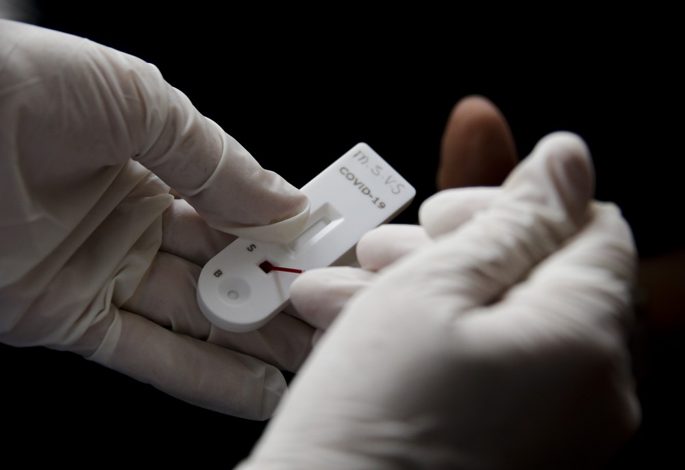 Testagem gratuita de Covid-19 é oferecida na Rodovia Raposo Tavares em Presidente Prudente