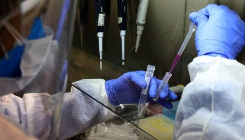 Sem sintomas, brasileira carregou coronavírus por 5 meses; caso é o mais longo já documentado