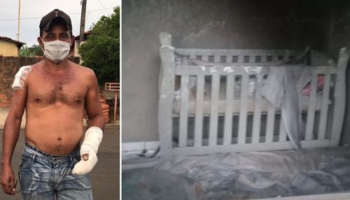 Bebê tem 70% do corpo queimados durante incêndio; vizinho arromba janela da casa para salvar criança