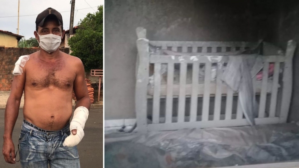 Bebê tem 70% do corpo queimados durante incêndio; vizinho arromba janela da casa para salvar criança