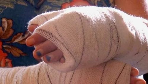 Criminoso condenado por estupro e roubo é beneficiado por 