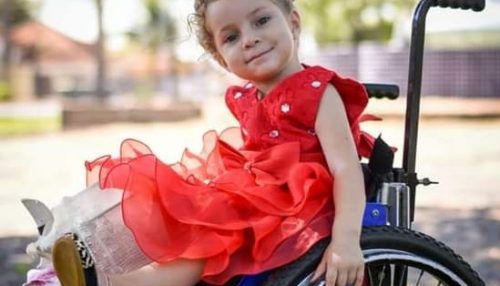 Prefeitura e departamento de saúde vão arcar com a cirurgia de Maria Clara, criança parapuense com doenças raras.