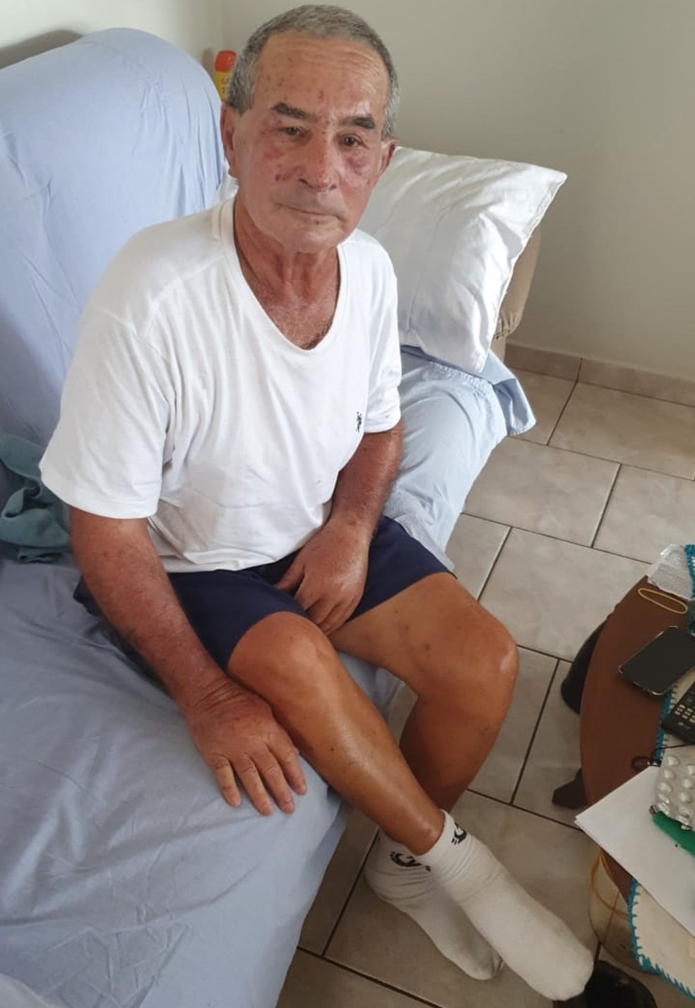 Idoso deficiente físico que foi vítima de ataque de abelhas recebe alta hospitalar e volta para casa; filha relata momentos de desespero