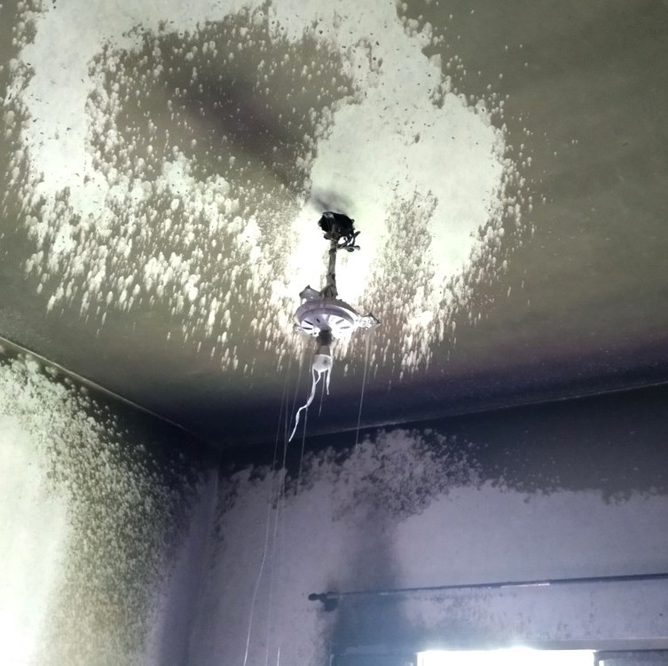 Idosa acamada e portadora de Alzheimer fica gravemente ferida em incêndio em residência