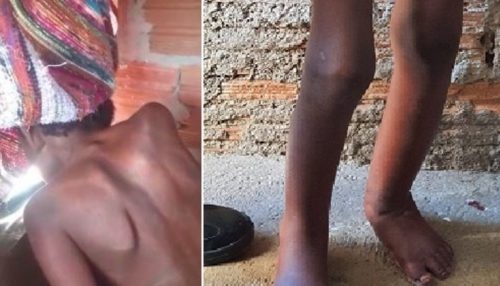 Menino acorrentado em tambor segue internado e deverá ir a abrigo