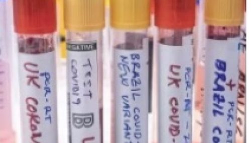 Variante delta: Pesquisa aponta disparada de casos em São Paulo em setembro