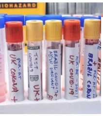 Variante delta: Pesquisa aponta disparada de casos em São Paulo em setembro