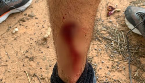 Funcionários da Prudenco são atacados por pitbulls durante coleta de lixo em Presidente Prudente