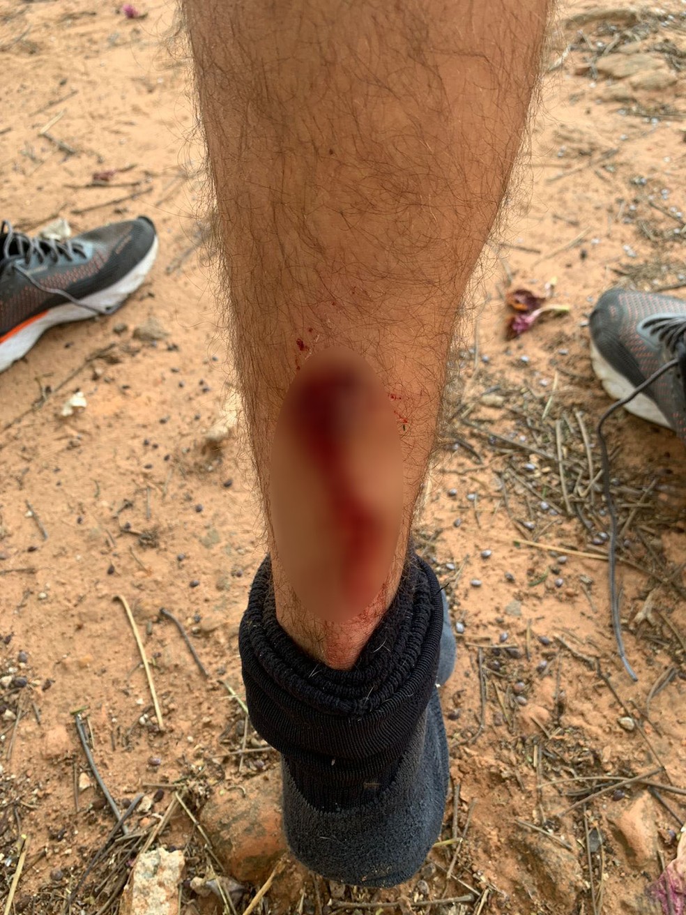 Funcionários da Prudenco são atacados por pitbulls durante coleta de lixo em Presidente Prudente