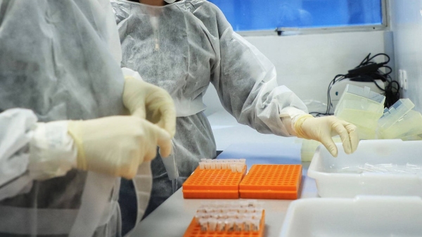 Modelo de testes para Covid-19 que a Saúde de Adamantina usa não detecta variantes