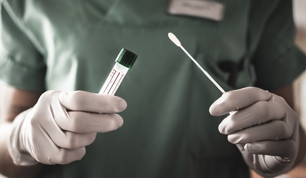 Prefeitura de Adamantina informa sobre a realização dos exames COVID-19 RT-PCR