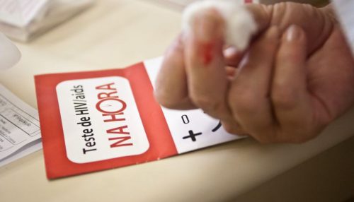 Anvisa aprova novo tratamento para HIV