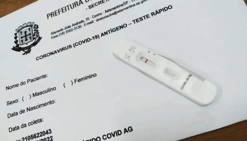 RESULTADO | A ação de testagem para a covid-19 neste sábado (22) em Adamantina