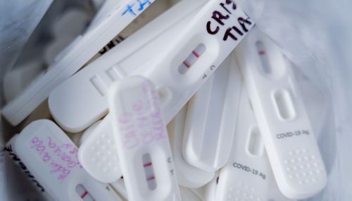 Procon-SP fiscaliza preços abusivos de testes de covid-19