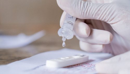 SP estabelece novas recomendações para isolamento em caso de Covid-19