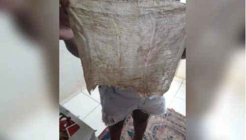 Mulher passa mal e descobre pano dentro de ânus 6 meses após cesárea