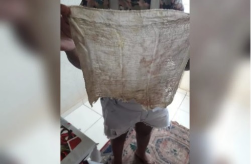 Mulher passa mal e descobre pano dentro de ânus 6 meses após cesárea