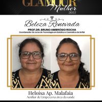 WhatsApp Image 2022 03 13 At 18.11.55