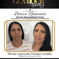 WhatsApp Image 2022 03 13 At 18.11.56