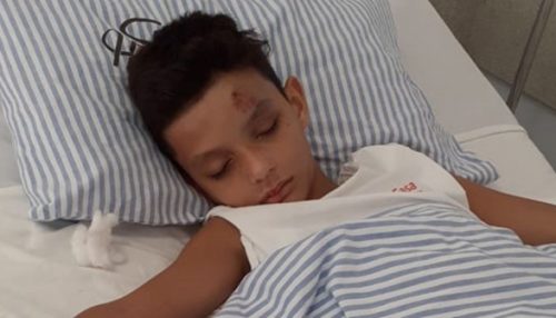 No hospital, menino de 10 anos se recupera de fraturas após ser atropelado na saída da escola