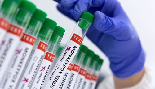 Fiocruz produz insumos para diagnóstico da varíola dos macacos