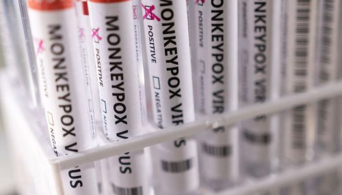 Varíola dos macacos: com 813 casos, Brasil tem situação 