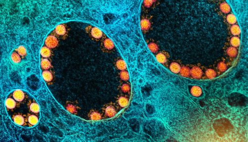 Fiocruz confirma subvariante Ômicron BQ.1 na cidade do Rio de Janeiro