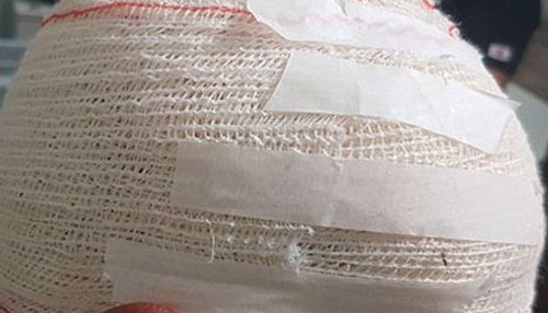 Homem é preso após tentativa de homicídio na Vila Esperança