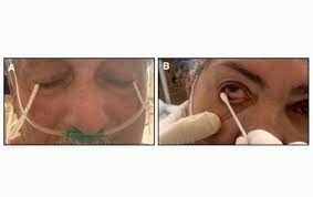 Estudo mostra que COVID-19 pode ser detectado em lágrimas com uso de swab