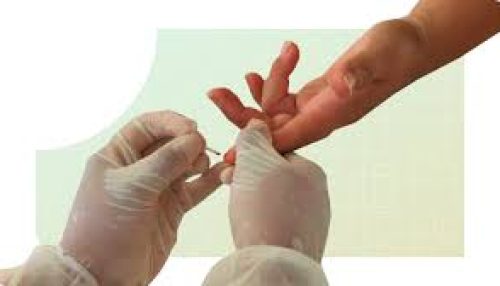 Anvisa atualiza norma que disciplina requisitos para exames de análises clínicas