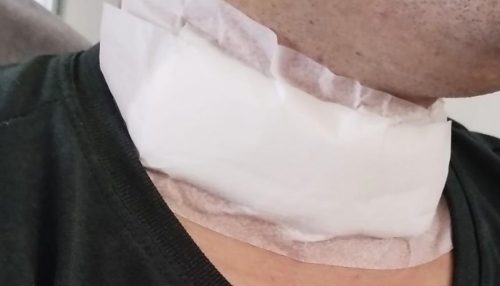 Motociclista de 28 anos fica ferido após ter o pescoço cortado por linha de cerol em Parapuã