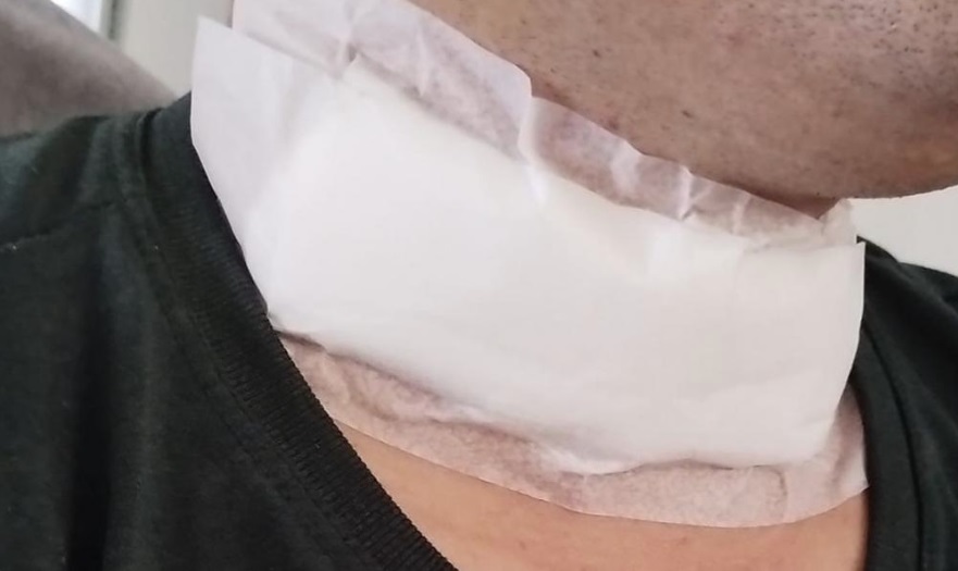 Motociclista de 28 anos fica ferido após ter o pescoço cortado por linha de cerol em Parapuã