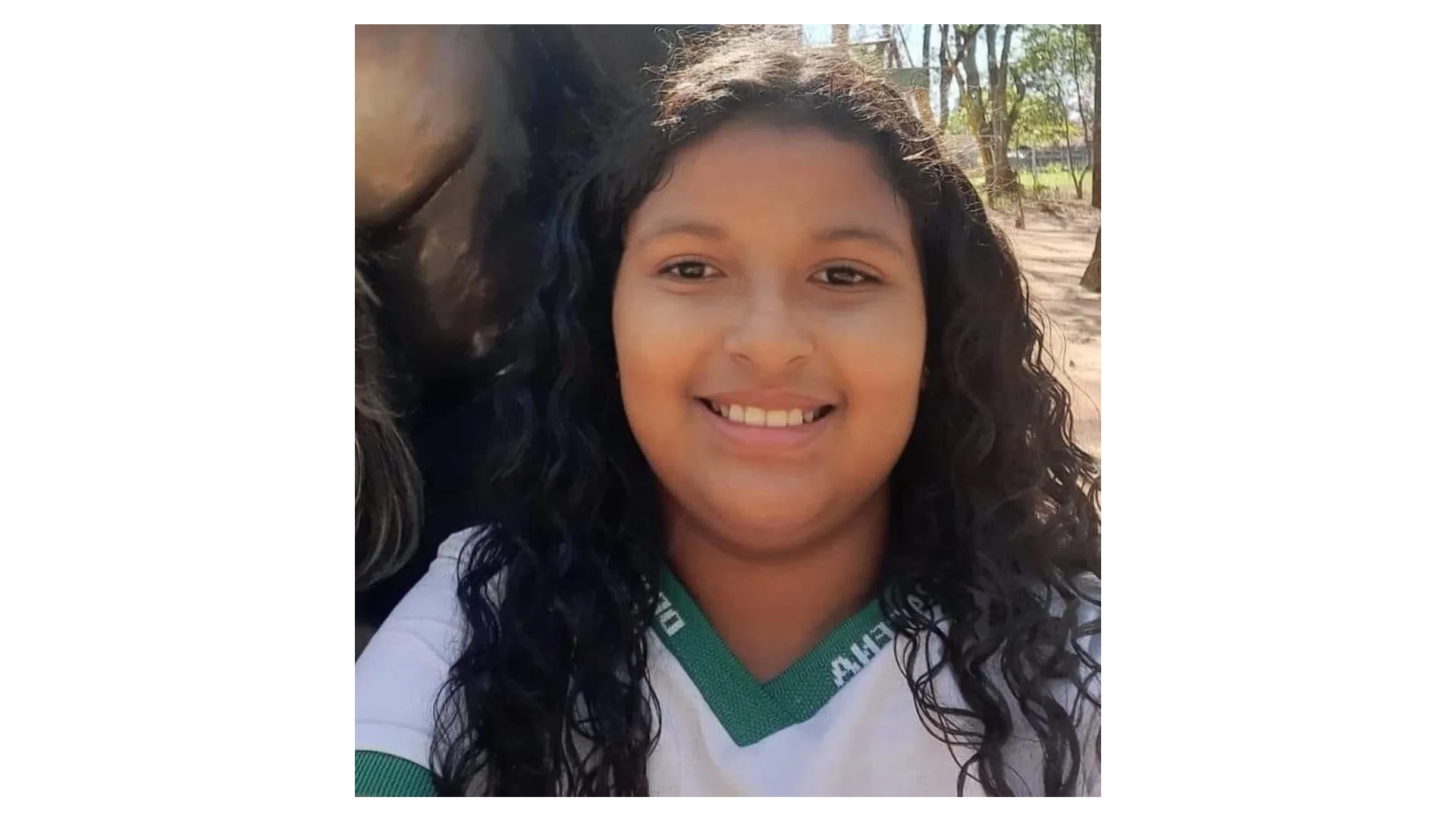 Criança de 10 anos morre após torcer o pé e fraturar bacia, em Dracena