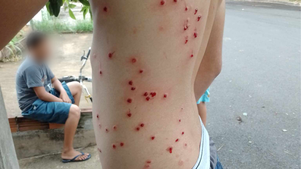 Em Lucélia jovem é atingido por disparos enquanto pilotava sua moto em vicinal