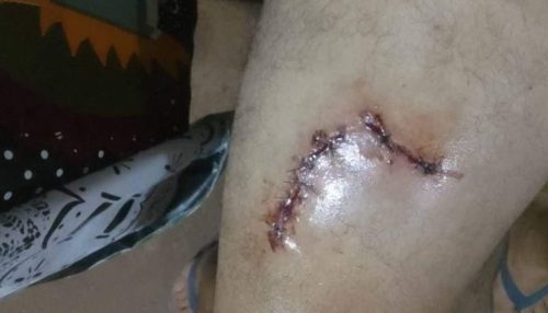 Homem é agredido com golpe de faca, em Salmourão