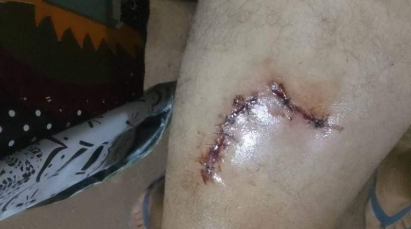 Homem é agredido com golpe de faca, em Salmourão