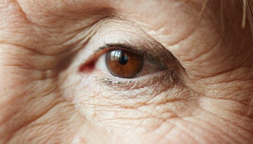 USP: mapeamento da retina pode indicar risco de Alzheimer com antecedência