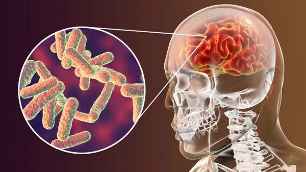 Osvaldo Cruz investiga morte de criança por suspeita de meningite bacteriana